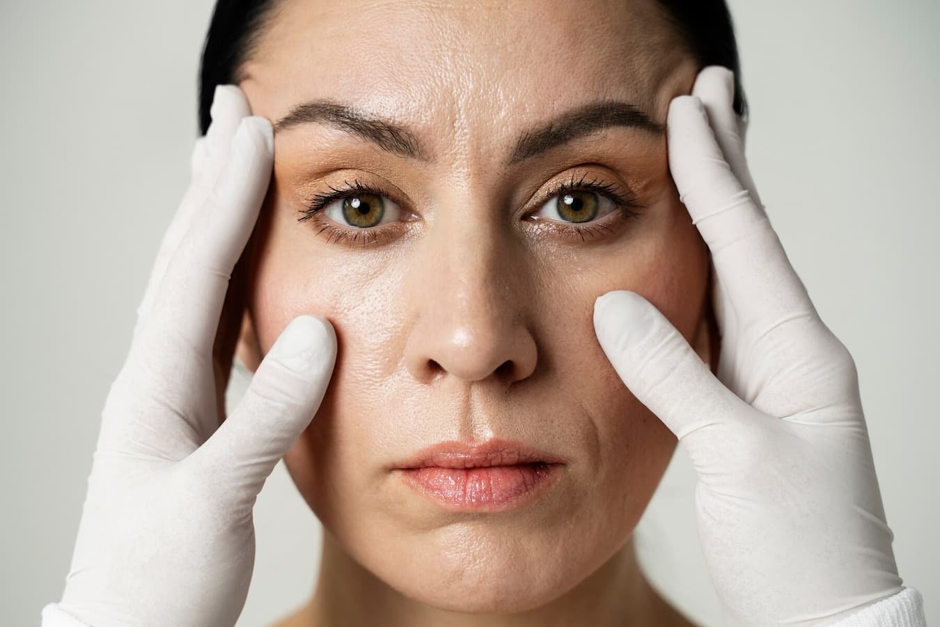 Flacidez Facial A Los 50